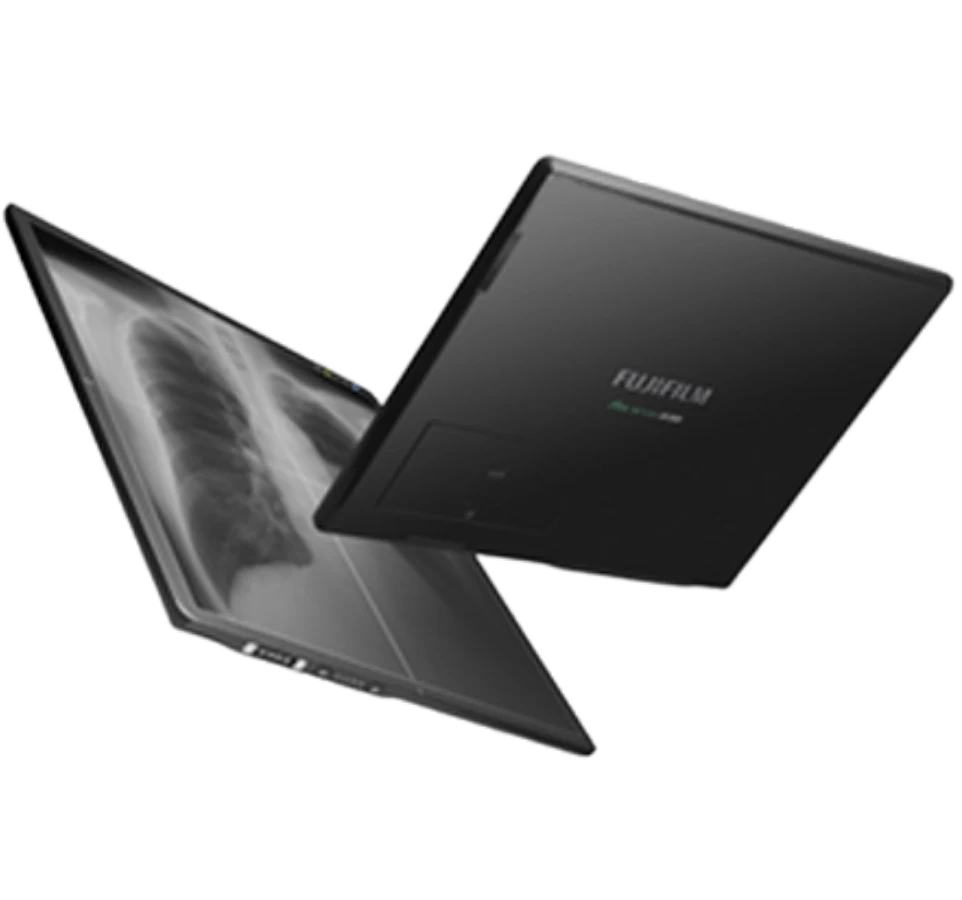 Flat Panel Detector (FPD) DR System